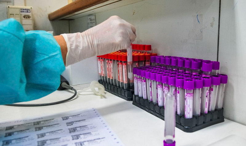 Rondônia registra 11 mortes em 24 horas e mais de 500 casos de Coronavírus; Cacaulândia registra 102 casos