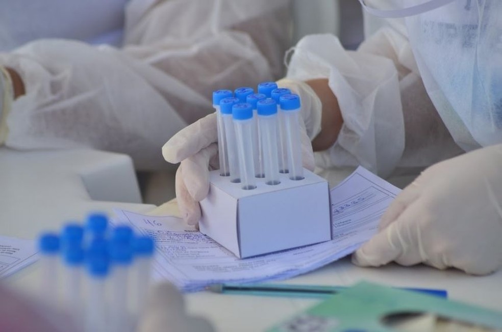 Rondônia registra 16 mortes e 989 novos casos nesta quarta-feira (16)